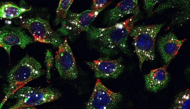 L'iniezione di nanoparticelle appiccicose con farmaci può ridurre il cancro della pelle