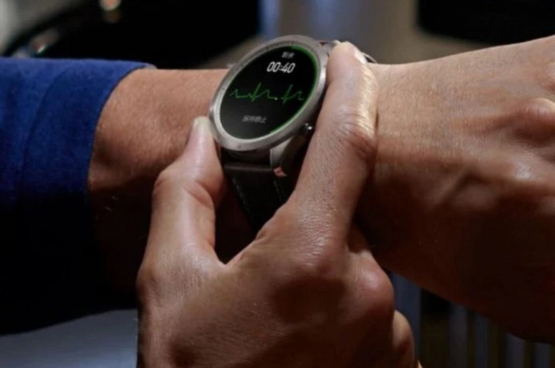 Die Zepp Z Smartwatch verfügt über alle Funktionen